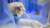 Ärzt:innen mit Skalpell in der Hand, Veranschaulichung zum Thema operative Myomentfernung